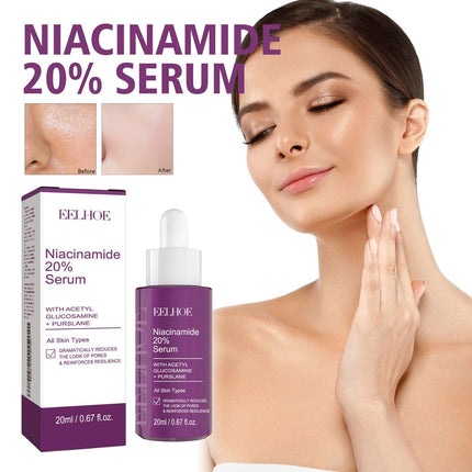 Niacinamide Serum – Lifting, Spot & Anti-Wrinkle