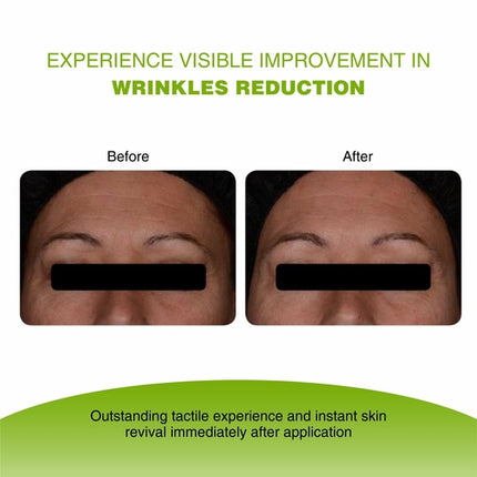 VIJUVE Advanced Vitamin C Face Serum – 45% Vitamin C, Double Hyaluronic Acid & Collagen Peptides for Anti-Aging, Skin Brightening & Wrinkle Reduction