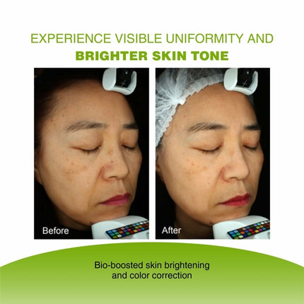 VIJUVE Advanced Vitamin C Face Serum – 45% Vitamin C, Double Hyaluronic Acid & Collagen Peptides for Anti-Aging, Skin Brightening & Wrinkle Reduction