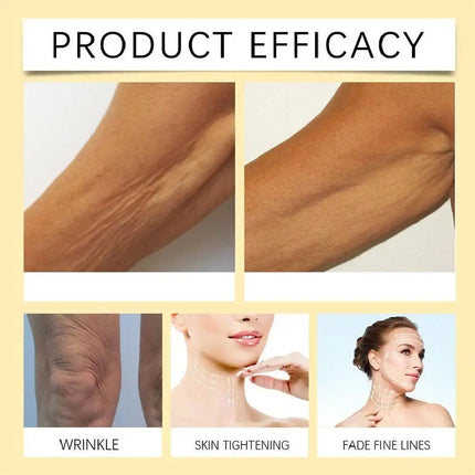 Korean Vita A Retinol Shot Serum – Firming & Moisturizing Nex Beauty