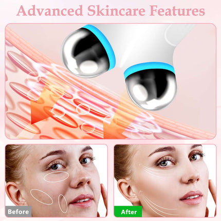 Anti-Aging Microcurrent Facial Device – Wrinkle Reducer